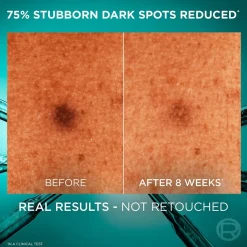 Dark Spot Serum 10% [Niacinamide + Melasyl™ + Amino-Sulfonic] To Fade Dark Spots