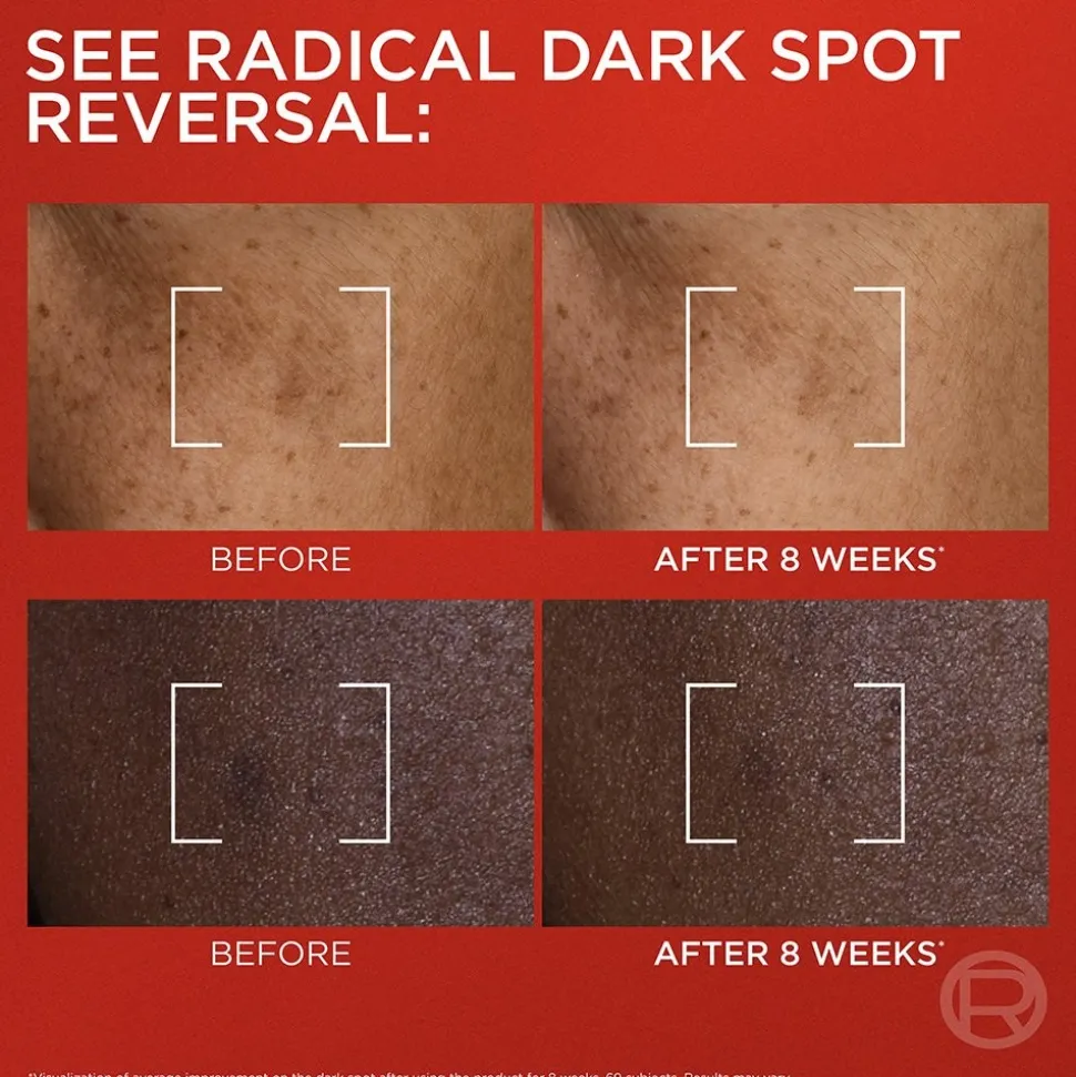 Triple Power Melasyl Dark Spot Creamy Serum for Darks Spots and Wrinkles